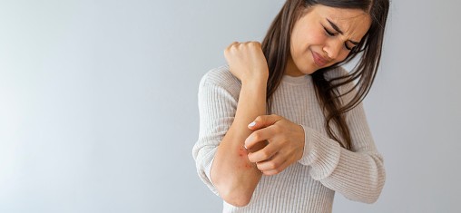 L’eczéma : qu’est-ce que c’est en réalité ?